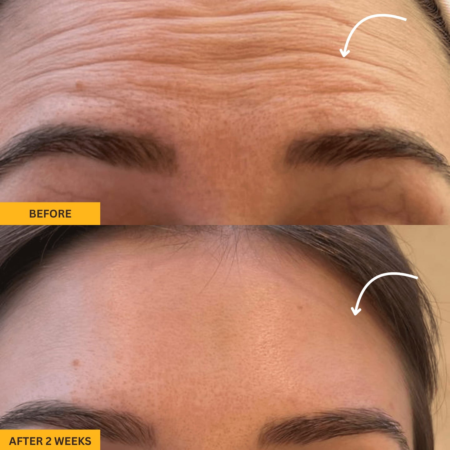 Lymphatic Contour Face Brush | Reduce Puffiness