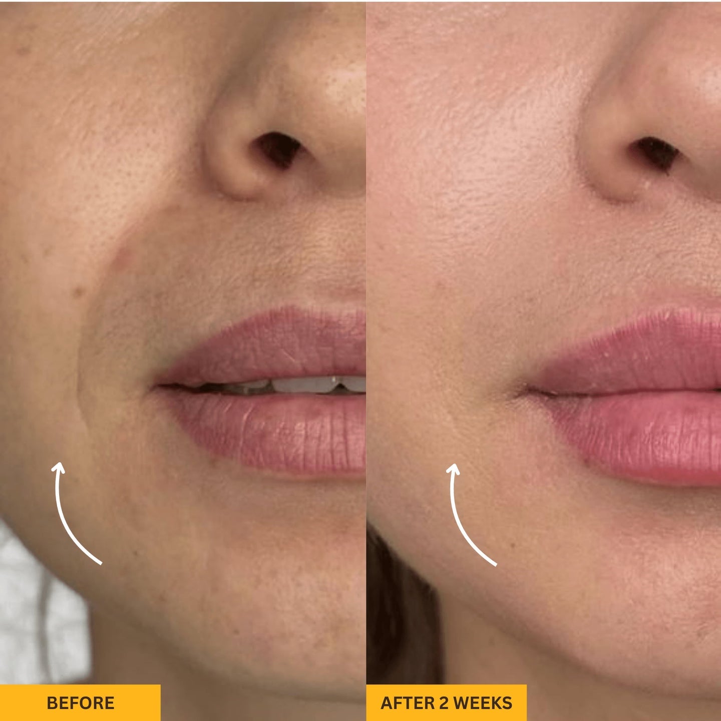 Lymphatic Contour Face Brush | Reduce Puffiness