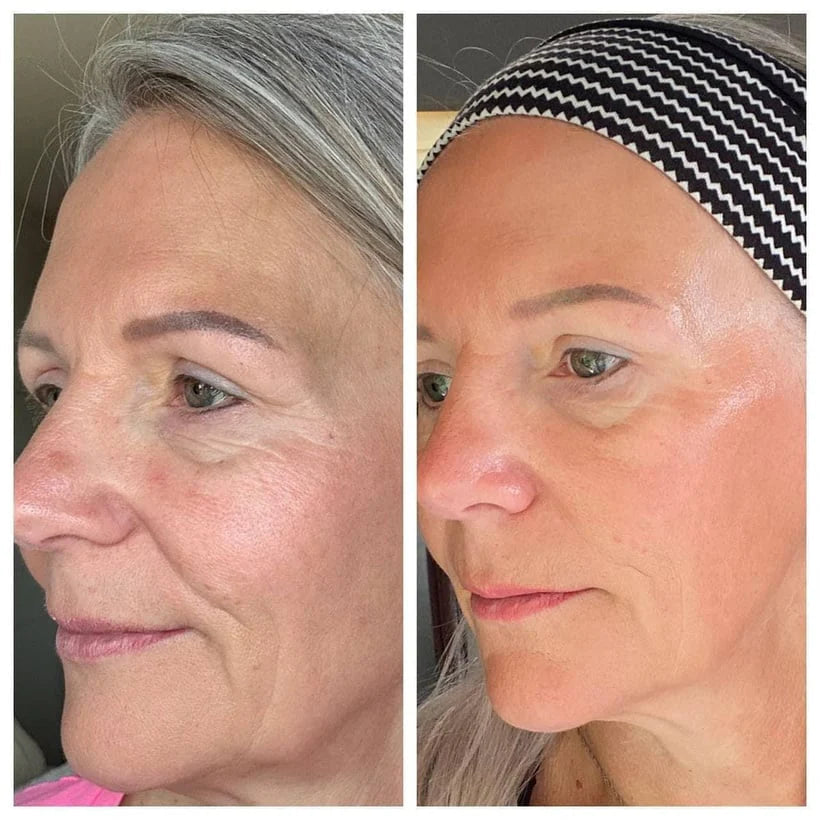 Lymphatic Contour Face Brush | Reduce Puffiness