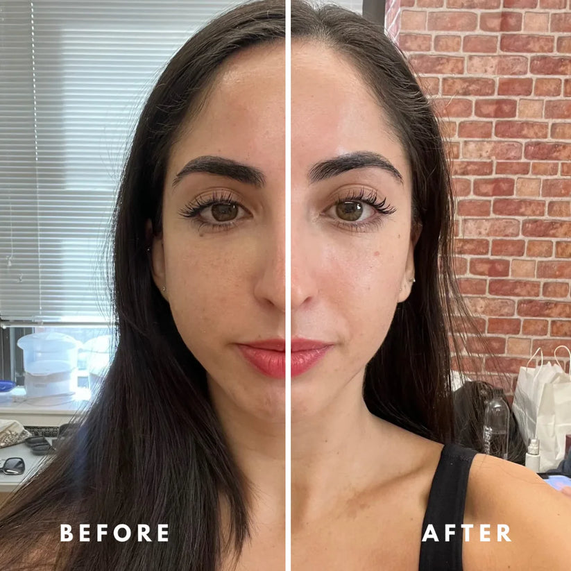 Lymphatic Contour Face Brush | Reduce Puffiness